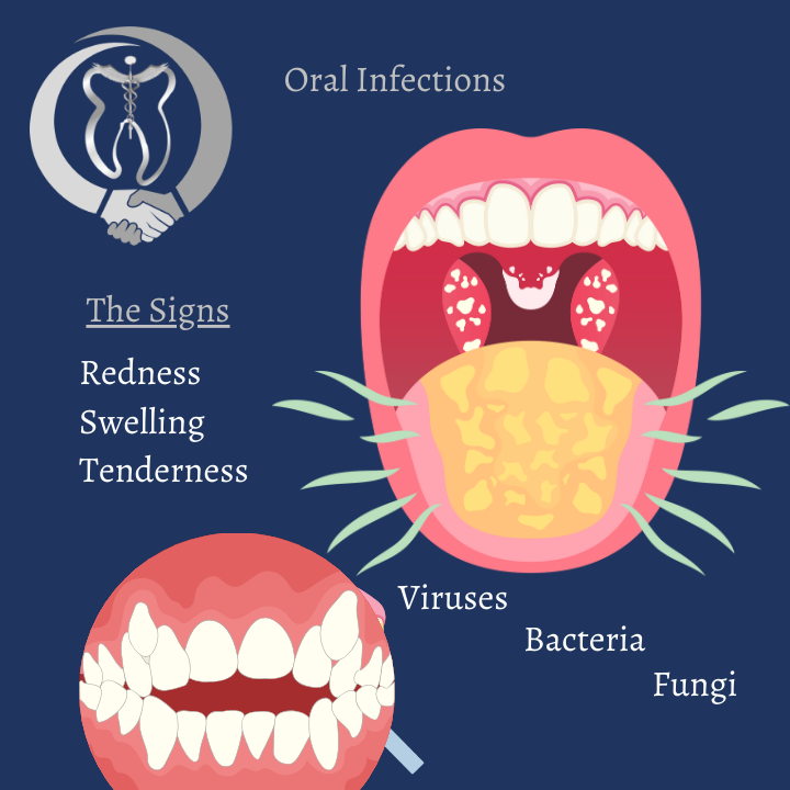 Family Dental Services poster about oral infections: signs are redness, swelling and tenderness, caused by viruses, bacteria and fungi